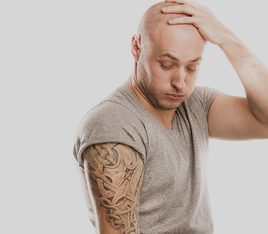 Everything you need to know about laser tattoo removal
