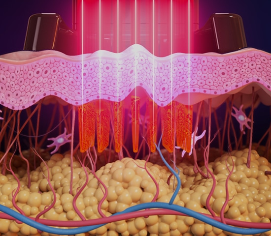 The Roles of Collagen and Elastin